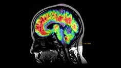 Neuro - MRI